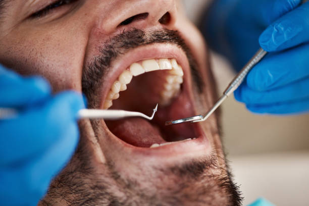 Best Broken or Cracked Tooth Emergency Dentist in Hot Springs Village, AR